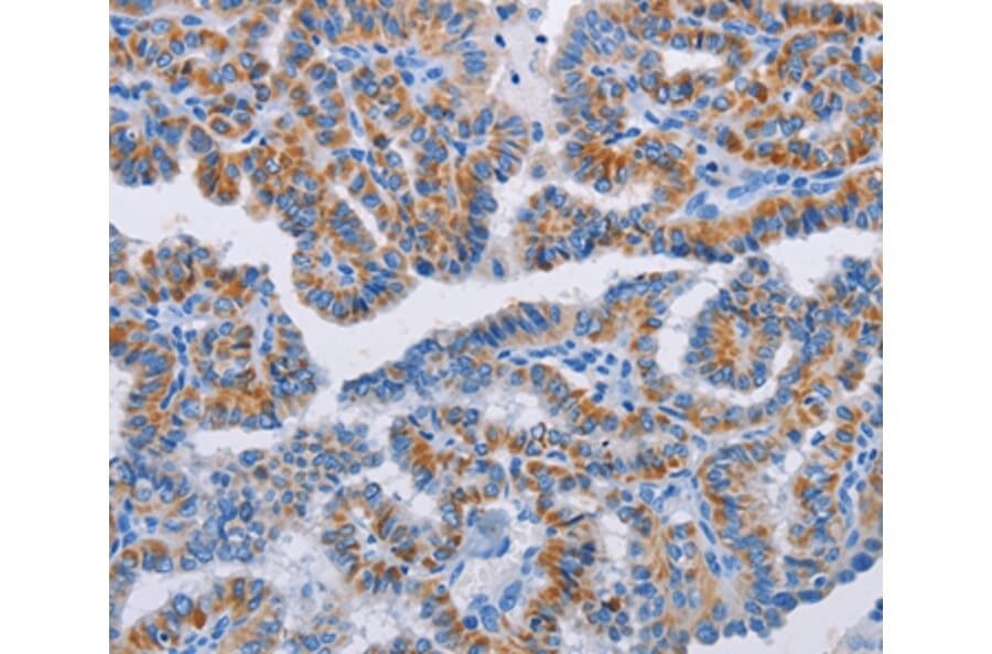 Immunohistochemistry - BCL2A1 Antibody from Signalway Antibody (35596) - Antibodies.com