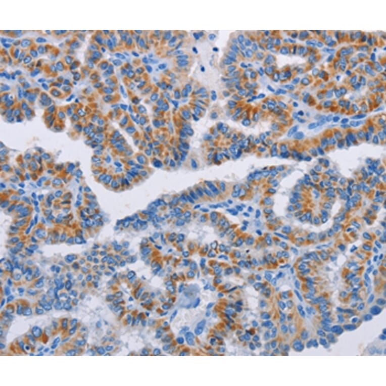 Immunohistochemistry - BCL2A1 Antibody from Signalway Antibody (35596) - Antibodies.com