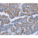 Immunohistochemistry - BCL2A1 Antibody from Signalway Antibody (35596) - Antibodies.com