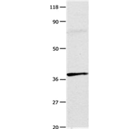 ADORA3 Antibody from Signalway Antibody (35615) - Antibodies.com