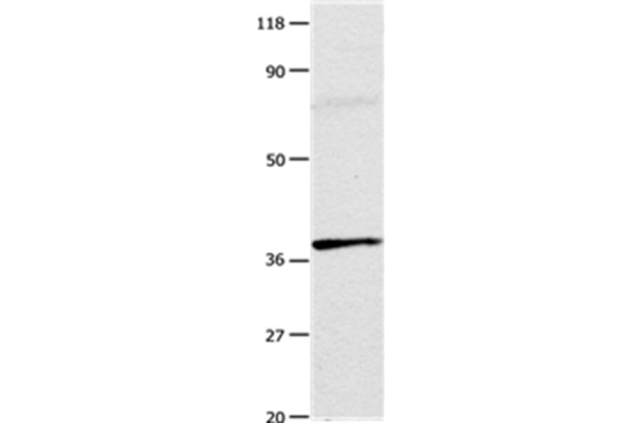 ADORA3 Antibody from Signalway Antibody (35615) - Antibodies.com