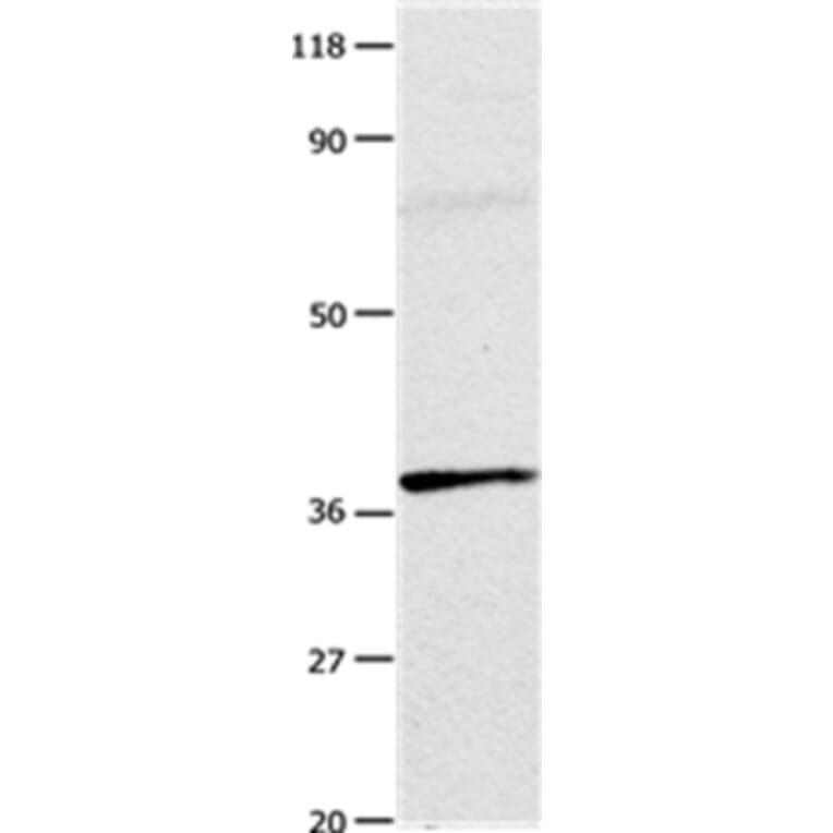 ADORA3 Antibody from Signalway Antibody (35615) - Antibodies.com