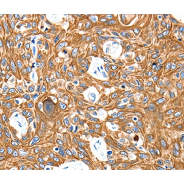 Immunohistochemistry - ADORA3 Antibody from Signalway Antibody (35615) - Antibodies.com