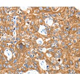 Immunohistochemistry - ADORA3 Antibody from Signalway Antibody (35615) - Antibodies.com
