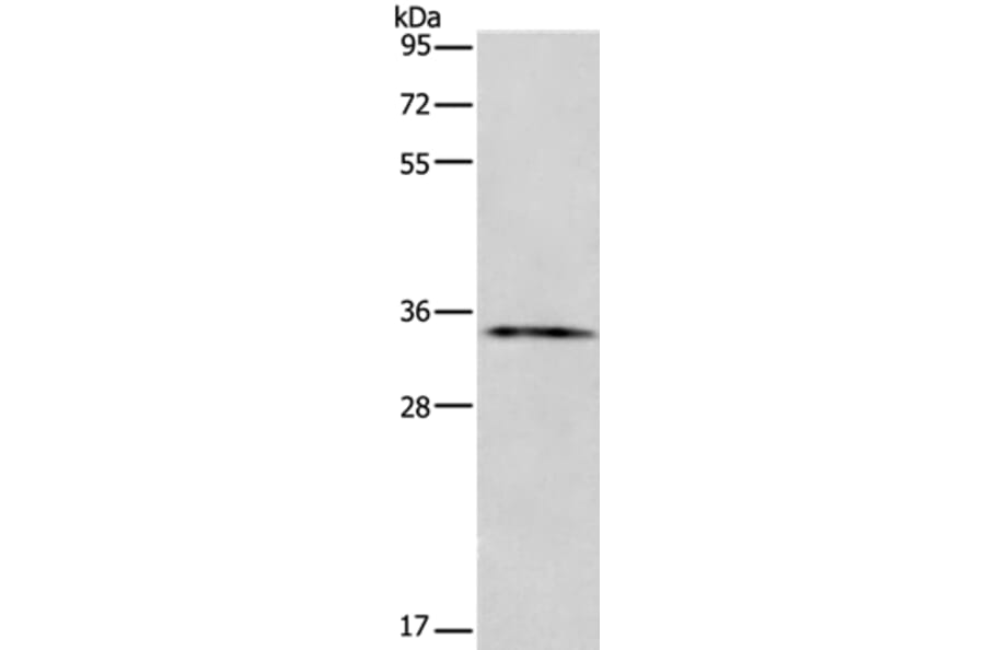 ANXA13 Antibody from Signalway Antibody (35622) - Antibodies.com