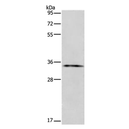 ANXA13 Antibody from Signalway Antibody (35622) - Antibodies.com