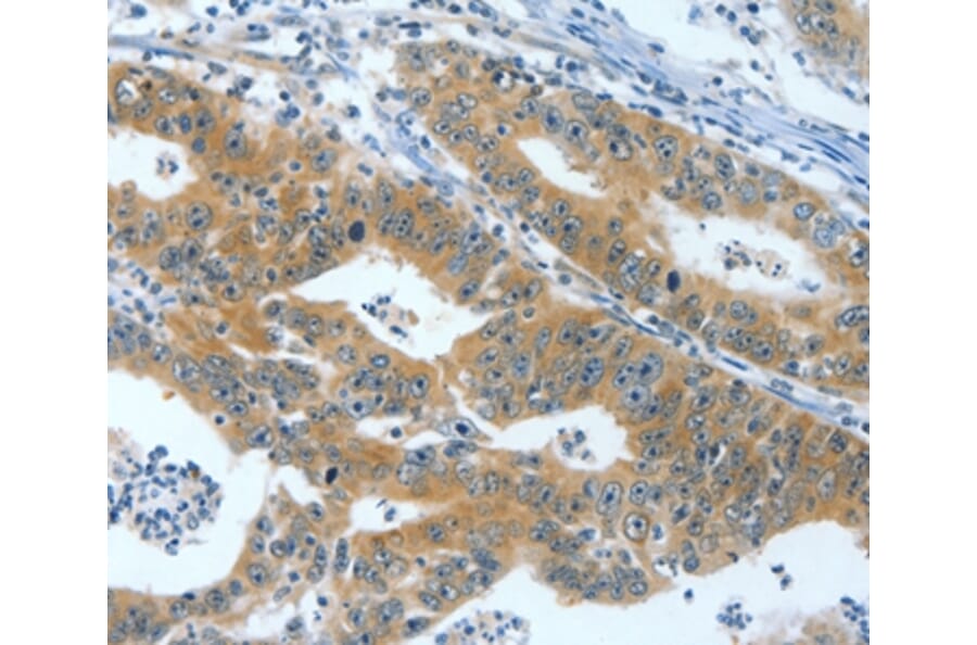 Immunohistochemistry - ANXA13 Antibody from Signalway Antibody (35622) - Antibodies.com