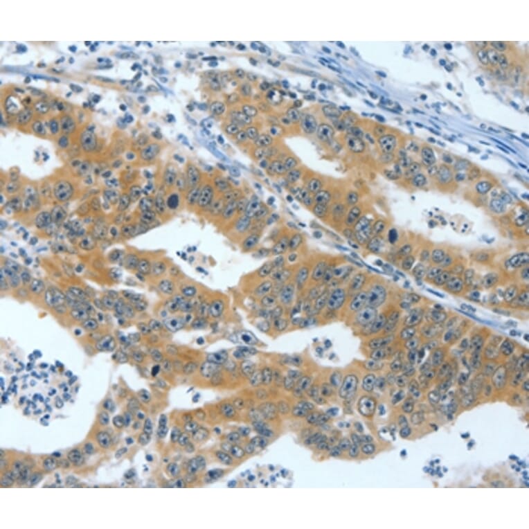 Immunohistochemistry - ANXA13 Antibody from Signalway Antibody (35622) - Antibodies.com