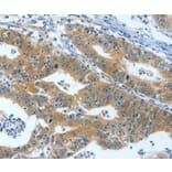 Immunohistochemistry - ANXA13 Antibody from Signalway Antibody (35622) - Antibodies.com