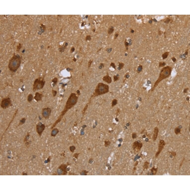 Immunohistochemistry - TRIM29 Antibody from Signalway Antibody (35641) - Antibodies.com