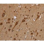 Immunohistochemistry - TRIM29 Antibody from Signalway Antibody (35641) - Antibodies.com