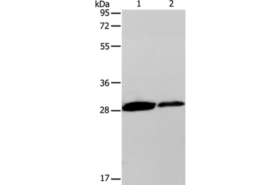 CLEC7A Antibody from Signalway Antibody (35673) - Antibodies.com