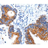 Immunohistochemistry - CLEC7A Antibody from Signalway Antibody (35673) - Antibodies.com