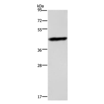 CHI3L1 Antibody from Signalway Antibody (35680) - Antibodies.com