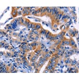 Immunohistochemistry - CHI3L1 Antibody from Signalway Antibody (35680) - Antibodies.com