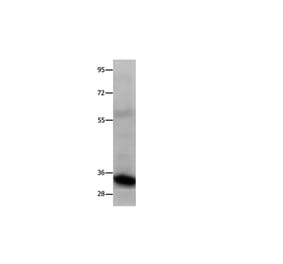 COL2A1 Antibody from Signalway Antibody (35690) - Antibodies.com