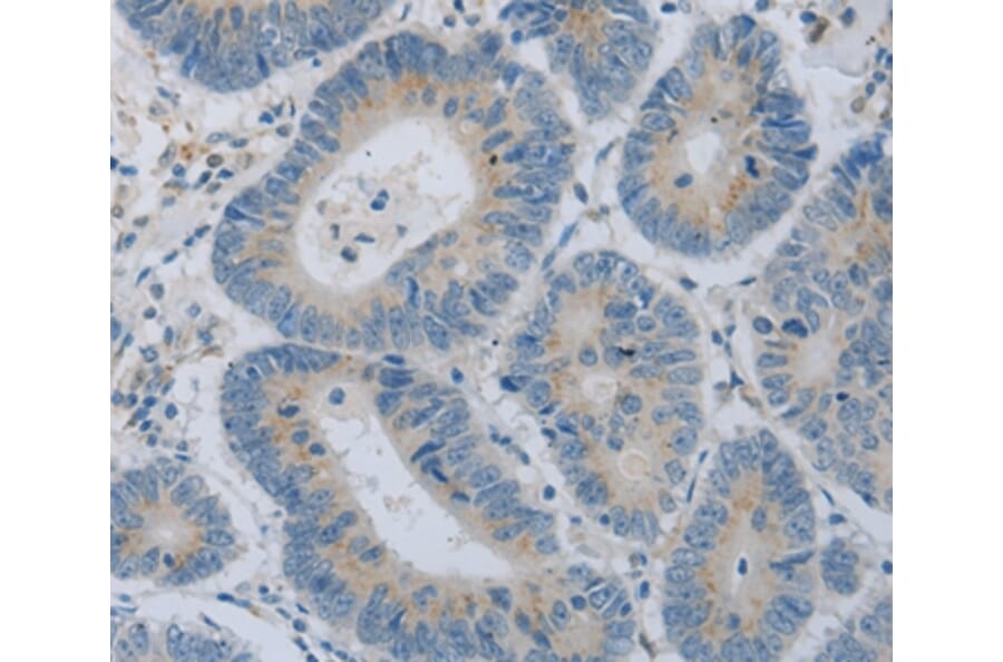 Immunohistochemistry - COL2A1 Antibody from Signalway Antibody (35690) - Antibodies.com