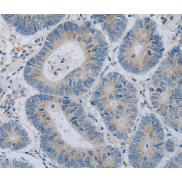 Immunohistochemistry - COL2A1 Antibody from Signalway Antibody (35690) - Antibodies.com