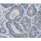 Immunohistochemistry - COL2A1 Antibody from Signalway Antibody (35690) - Antibodies.com