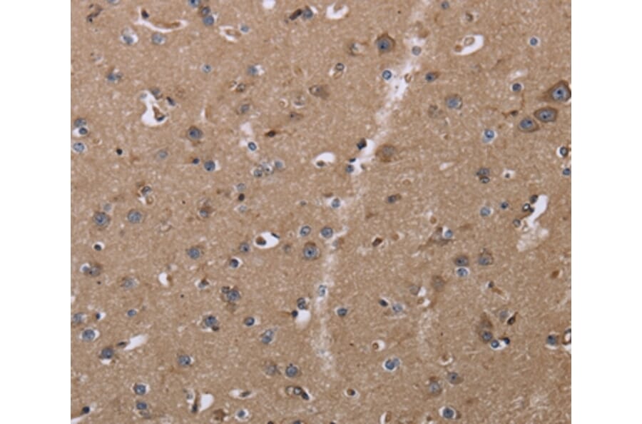 Immunohistochemistry - CLDN23 Antibody from Signalway Antibody (35693) - Antibodies.com