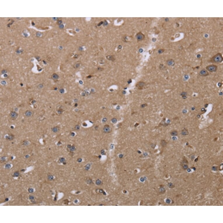 Immunohistochemistry - CLDN23 Antibody from Signalway Antibody (35693) - Antibodies.com