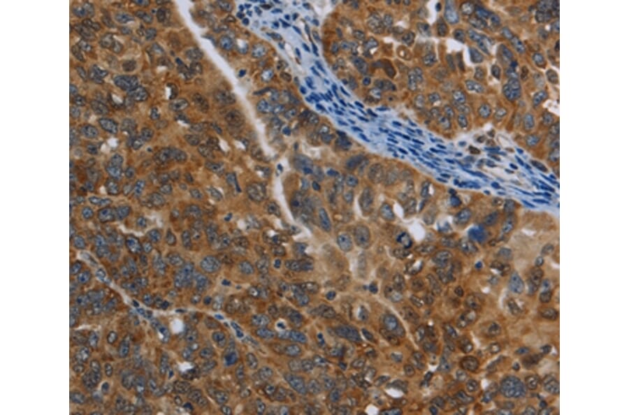 Immunohistochemistry - COX6B2 Antibody from Signalway Antibody (35695) - Antibodies.com