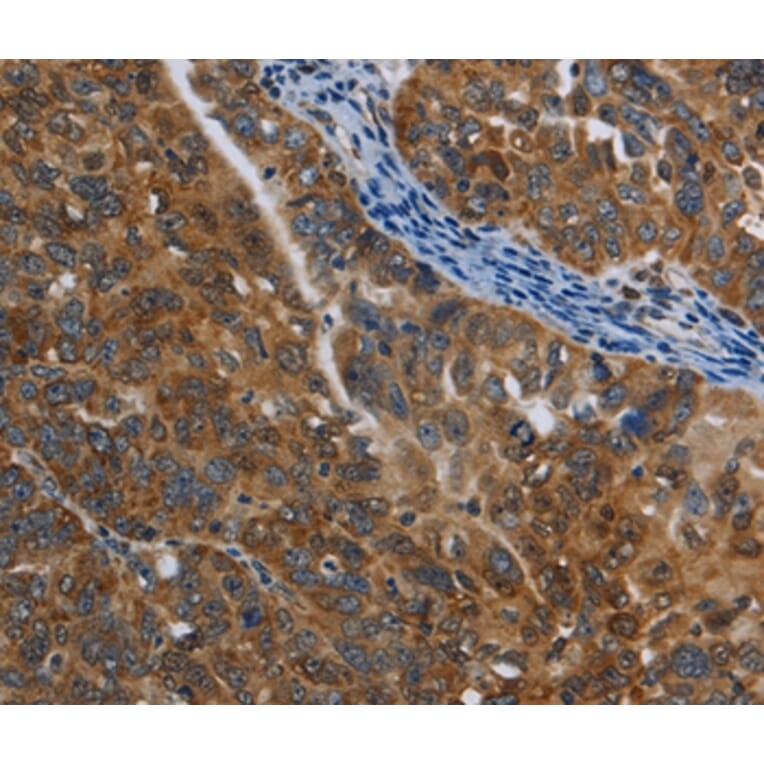 Immunohistochemistry - COX6B2 Antibody from Signalway Antibody (35695) - Antibodies.com