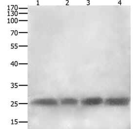 CLEC4A Antibody from Signalway Antibody (35707) - Antibodies.com