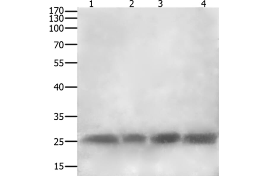 CLEC4A Antibody from Signalway Antibody (35707) - Antibodies.com