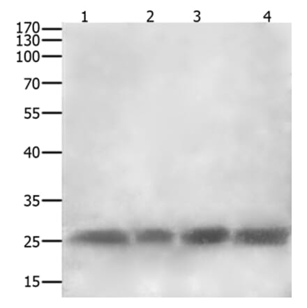 CLEC4A Antibody from Signalway Antibody (35707) - Antibodies.com