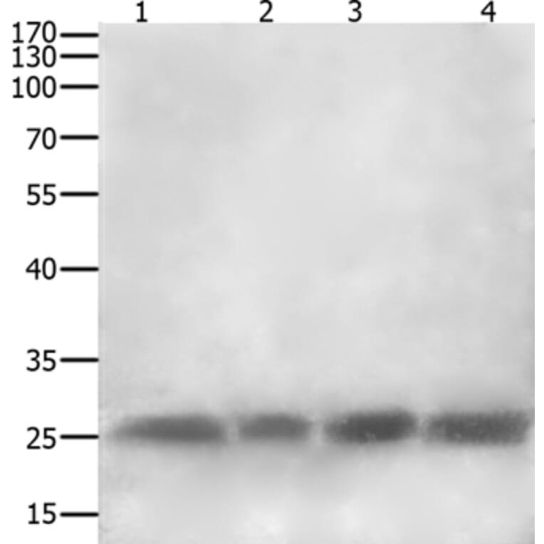 CLEC4A Antibody from Signalway Antibody (35707) - Antibodies.com