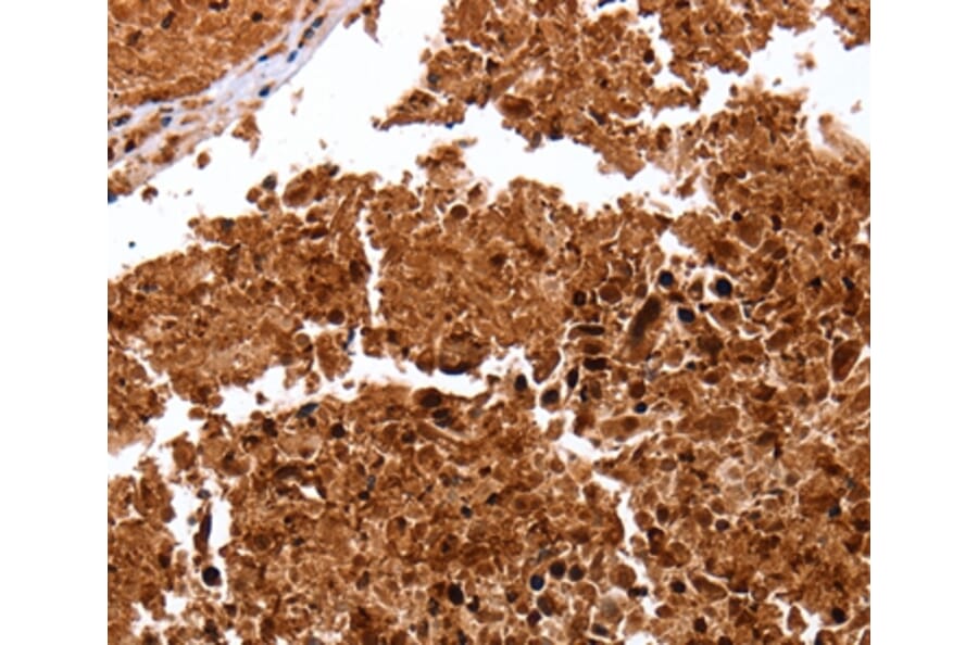 Immunohistochemistry - CLEC4A Antibody from Signalway Antibody (35707) - Antibodies.com