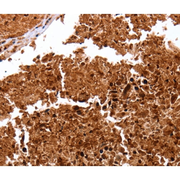 Immunohistochemistry - CLEC4A Antibody from Signalway Antibody (35707) - Antibodies.com