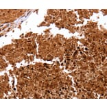 Immunohistochemistry - CLEC4A Antibody from Signalway Antibody (35707) - Antibodies.com