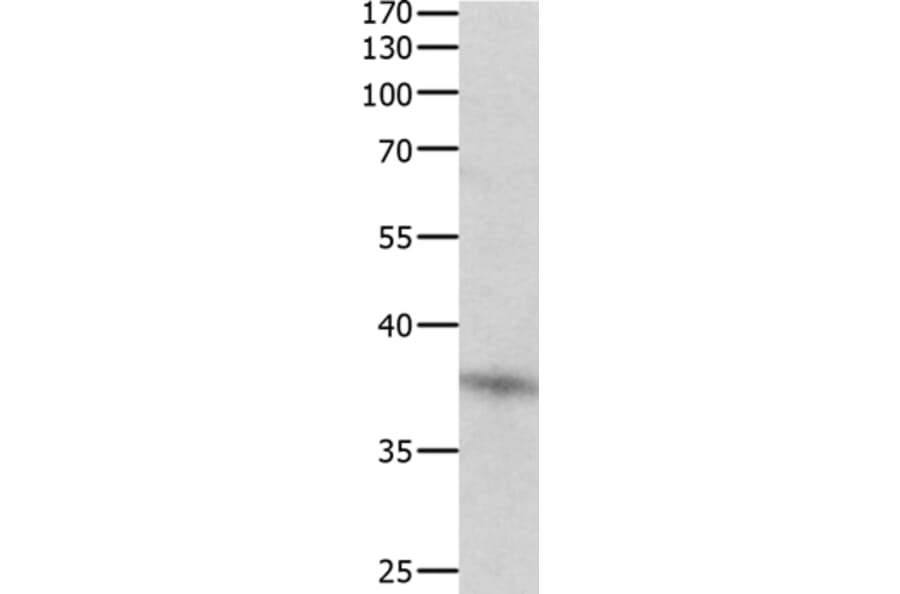 DUSP12 Antibody from Signalway Antibody (35731) - Antibodies.com