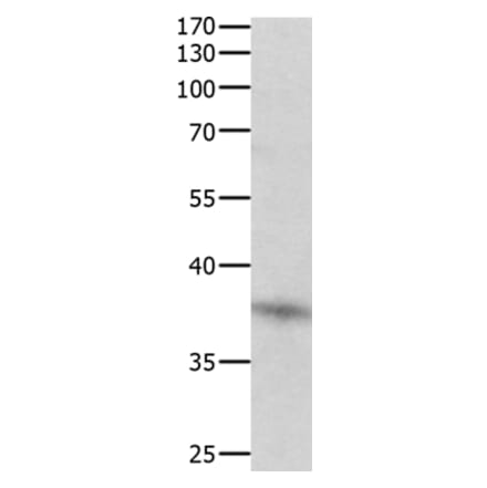 DUSP12 Antibody from Signalway Antibody (35731) - Antibodies.com