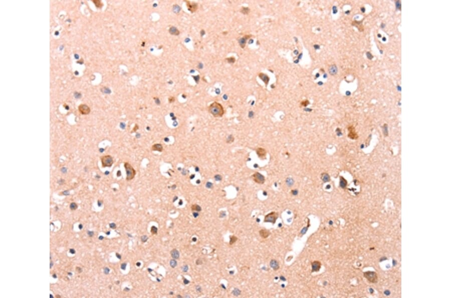 Immunohistochemistry - DUSP12 Antibody from Signalway Antibody (35731) - Antibodies.com