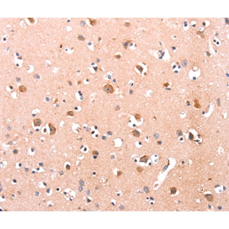 Immunohistochemistry - DUSP12 Antibody from Signalway Antibody (35731) - Antibodies.com