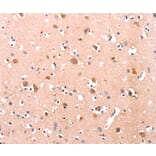 Immunohistochemistry - DUSP12 Antibody from Signalway Antibody (35731) - Antibodies.com