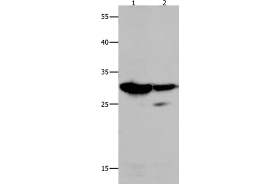 LGALS3 Antibody from Signalway Antibody (35747) - Antibodies.com