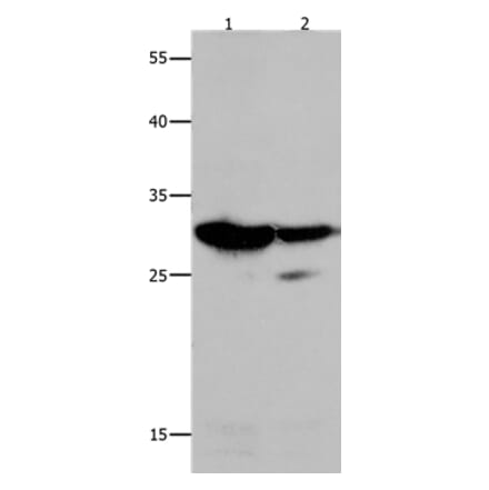 LGALS3 Antibody from Signalway Antibody (35747) - Antibodies.com