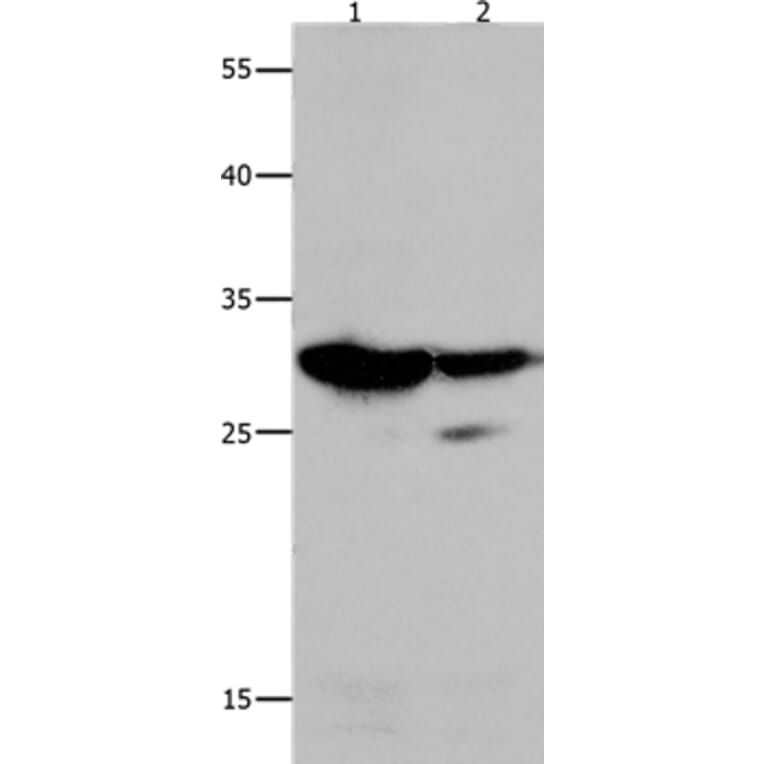 LGALS3 Antibody from Signalway Antibody (35747) - Antibodies.com