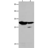LGALS3 Antibody from Signalway Antibody (35747) - Antibodies.com