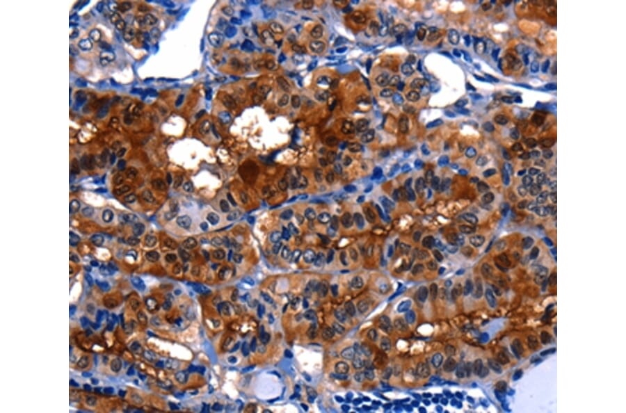 Immunohistochemistry - LGALS3 Antibody from Signalway Antibody (35747) - Antibodies.com