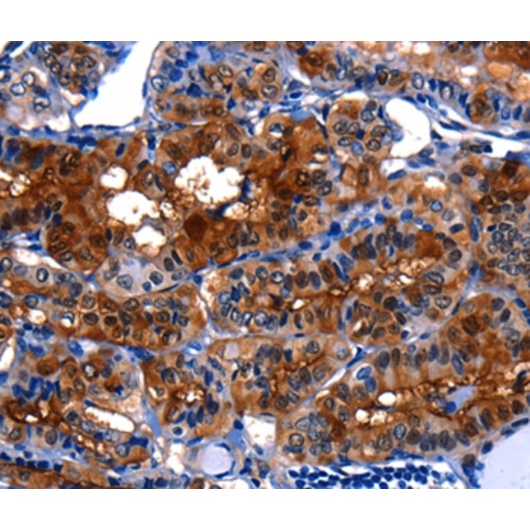 Immunohistochemistry - LGALS3 Antibody from Signalway Antibody (35747) - Antibodies.com
