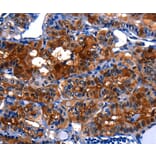 Immunohistochemistry - LGALS3 Antibody from Signalway Antibody (35747) - Antibodies.com