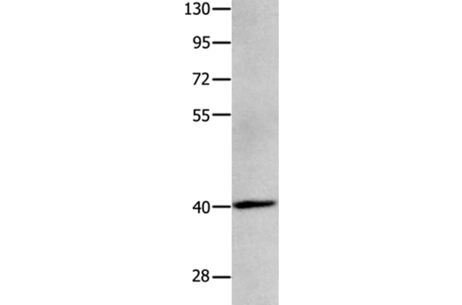 MAGEB4 Antibody from Signalway Antibody (35808) - Antibodies.com