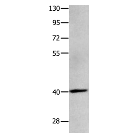 MAGEB4 Antibody from Signalway Antibody (35808) - Antibodies.com