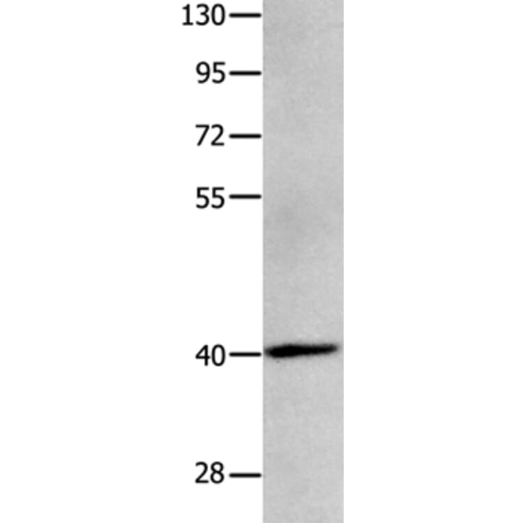 MAGEB4 Antibody from Signalway Antibody (35808) - Antibodies.com