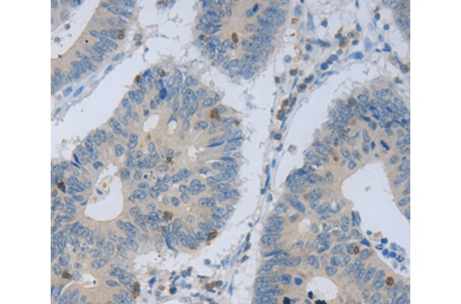 Immunohistochemistry - MAGEB4 Antibody from Signalway Antibody (35808) - Antibodies.com
